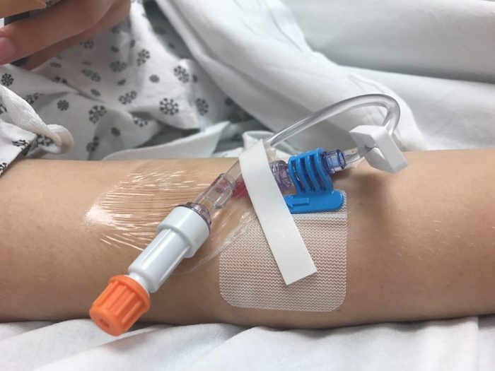 Iv catheter peripheral cannulation inserting technique